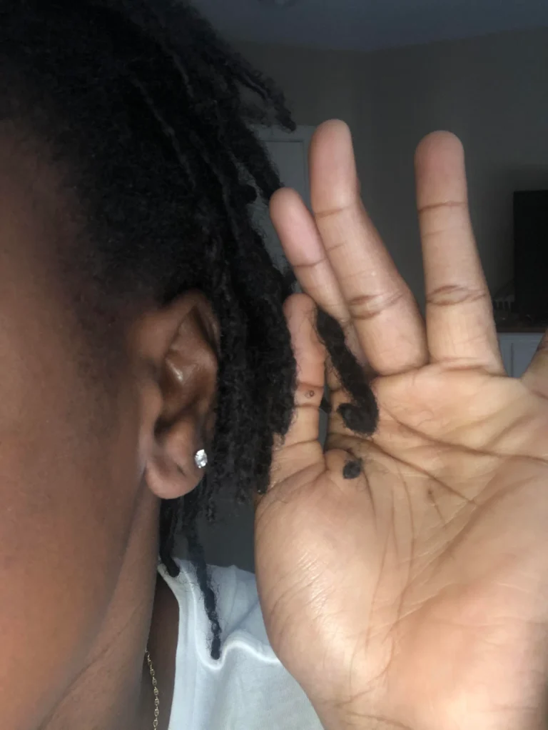 Balls At the End of Locs: Reasons, Solutions, and Tips for Healthy Dreadlocks
