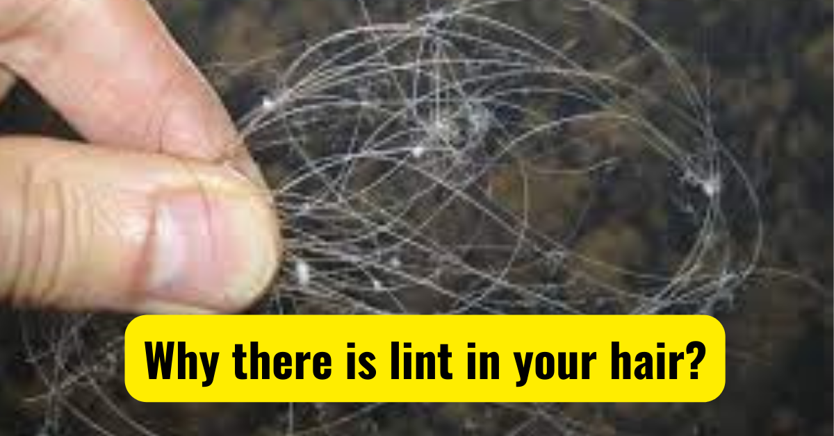 Why there is lint in your hair